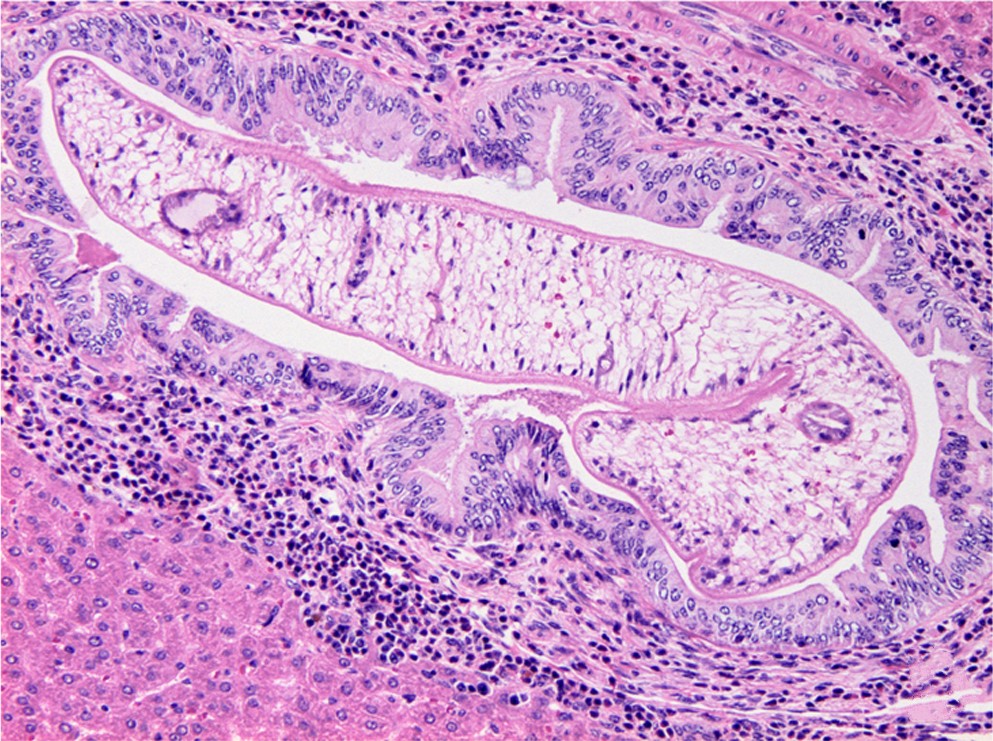 'Opistorchis viverrini', parásito causante de la opistorquiasis.