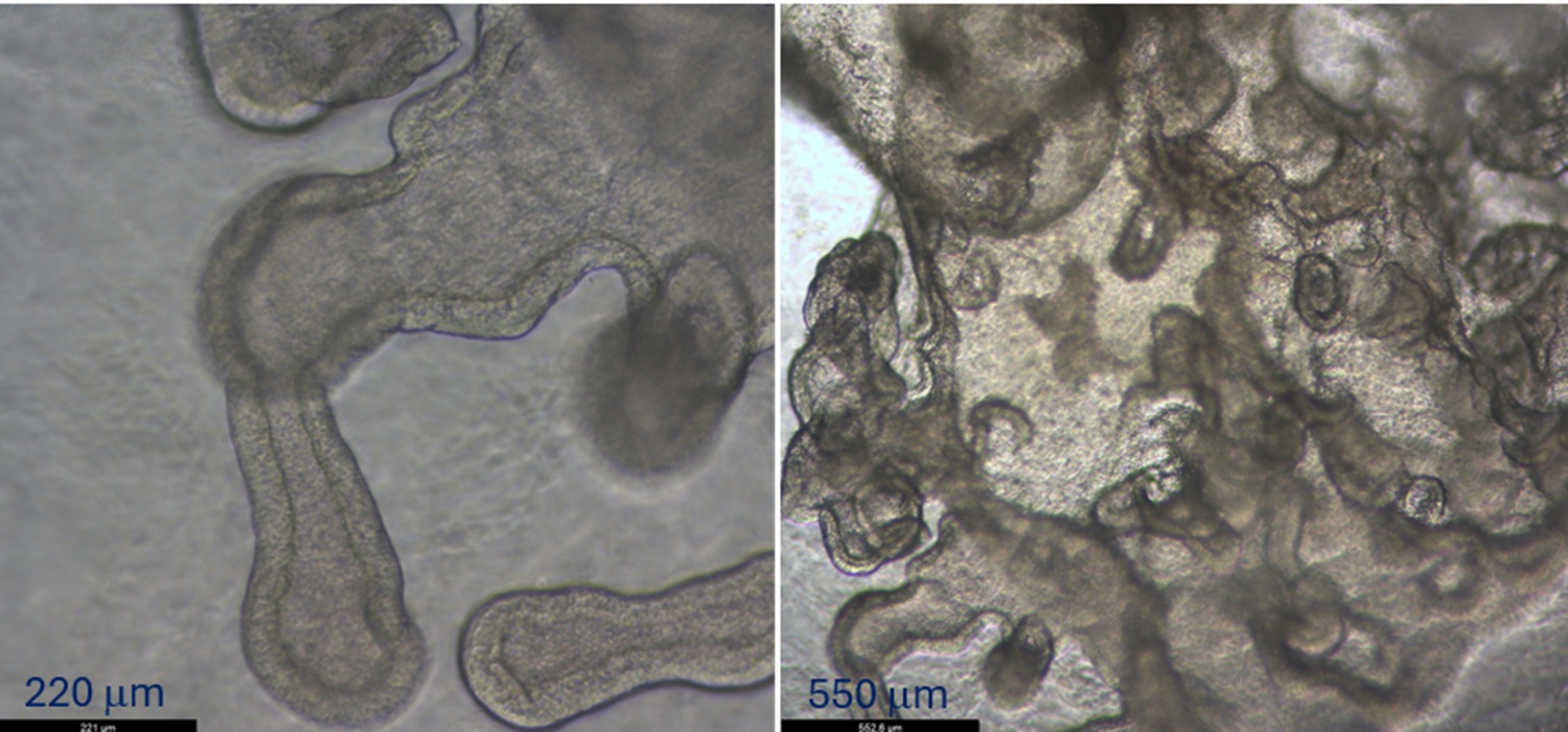 Dos imágenes de 'mini-pulmones' generados en laboratorio. Imagen: UFIEC-ISCIII.