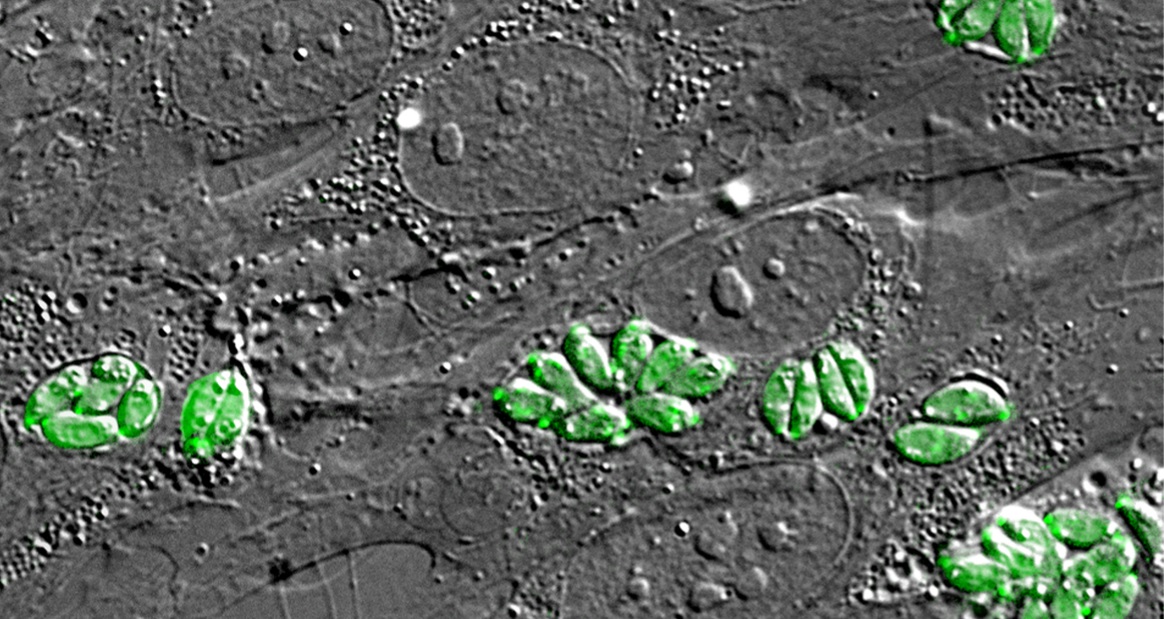 Imagen coloreada al microscopio del parásito 'toxoplasma gondii', causante de la toxoplasmosis (imagen: CDC).