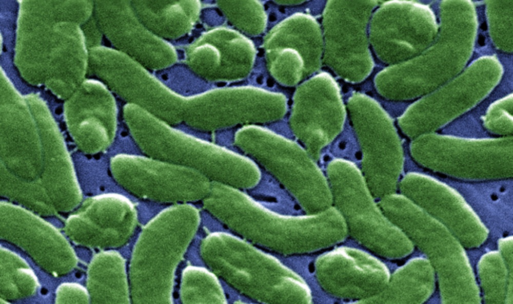 Imagen al microscopio, coloreada, de la bacteria 'Vibrio vulnificus'.