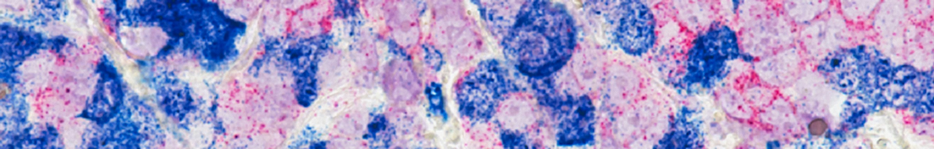 Banner del área de Oncología