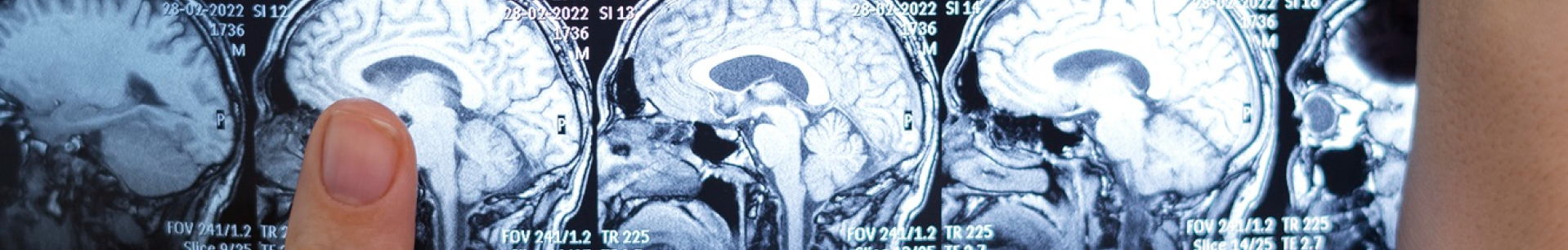 Banner sobre el Área de Neurociencia