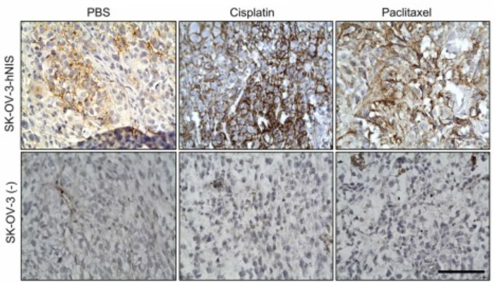 Diferentes momentos de expresión de la proteína NIS en tejidos tumorales de líneas celulares SK-OV-3, tratados y no tratados con fármacos antitumorales.